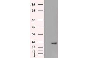 HEK293T cells were transfected with the pCMV6-ENTRY control (Left lane) or pCMV6-ENTRY AK1 (Right lane) cDNA for 48 hrs and lysed. (Adenylate Kinase 1 抗体)