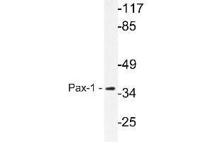 Western blot (WB) analysis of Pax-1 antibody in extracts from HeLa cells. (PAX1 抗体)