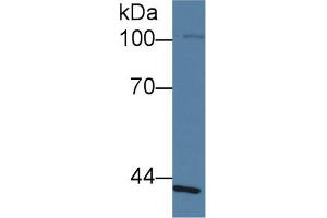 Western Blot; Sample: Human Lung lysate; ;Primary Ab: 1µg/ml Rabbit Anti-Human SLFN5 Antibody;Second Ab: 0. (SLFN5 抗体  (AA 658-891))