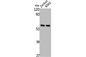 Western Blot analysis of Jurkat K562 cells using SS-56 Polyclonal Antibody (TRIM68 抗体  (Internal Region))