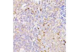 Immunohistochemistry of paraffin-embedded rat spleen using PSMG1 antibody (ABIN7269593) at dilution of 1:100 (40x lens). (PSMG1 抗体  (AA 1-288))