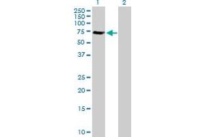 Western Blotting (WB) image for anti-Golgi-Associated, gamma Adaptin Ear Containing, ARF Binding Protein 1 (GGA1) (AA 1-552) antibody (ABIN525585)