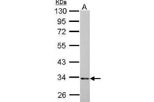 WB Image HADH antibody detects HADH protein by Western blot analysis.