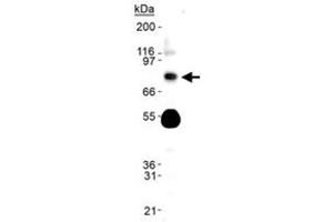 Western blot analysis of Phospho-Slc9a3 in human kidney lysate using with Slc9a3 (phospho S552) monoclonal antibody, clone 14D5 . (SLC9A3 抗体  (pSer552))