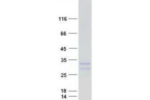 Validation with Western Blot