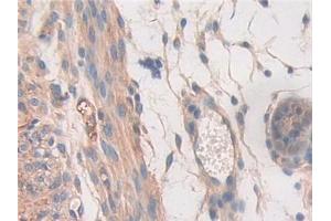 DAB staining on IHC-P; Samples: Mouse Uterus Tissue (STAT2 抗体  (AA 658-912))