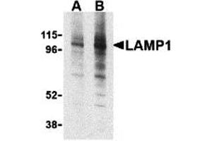 Western Blotting (WB) image for anti-Lysosomal-Associated Membrane Protein 1 (LAMP1) (Middle Region) antibody (ABIN1030977) (LAMP1 抗体  (Middle Region))