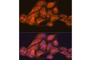 Immunofluorescence analysis of U-2 OS cells using CLOCK Rabbit mAb (ABIN7266414) at dilution of 1:100 (40x lens). (CLOCK 抗体)
