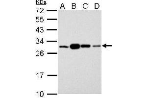 Western Blotting (WB) image for anti-Stratifin (SFN) (C-Term) antibody (ABIN2854692)