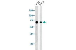 The RAD9A (phospho S387) polyclonal antibody  is used in Western blot to detect Phospho-RAD9A-S387 in Y-79 (left) and Hela (right) cell lysate.