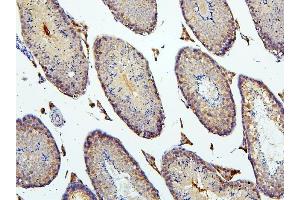 IHC analysis of BUB1B using anti-BUB1B antibody (ABIN7600962). (BUB1B 抗体  (AA 26-448))