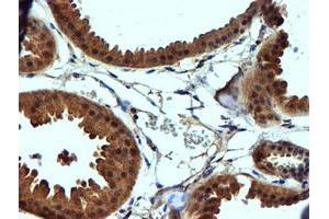 Immunohistochemical staining of paraffin-embedded Human breast tissue using anti-C2orf56 mouse monoclonal antibody. (NDUFAF7 抗体)