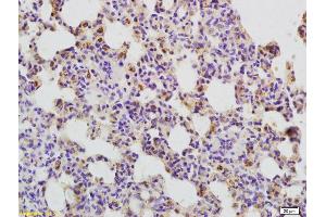 Immunohistochemistry (IHC) image for anti-Tumor Necrosis Factor Receptor Superfamily, Member 4 (TNFRSF4) (AA 101-200) antibody (ABIN749108)