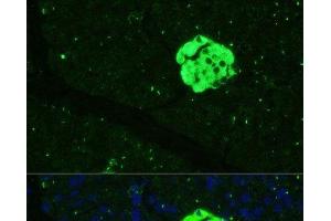 Immunofluorescence analysis of Mouse pancreas using SFRP5 Polyclonal Antibody at dilution of 1:100 (40x lens). (SFRP5 抗体)