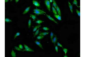 Immunofluorescence staining of Hela cells with ABIN7147441 at 1:100, counter-stained with DAPI. (CEP97 抗体  (AA 719-854))