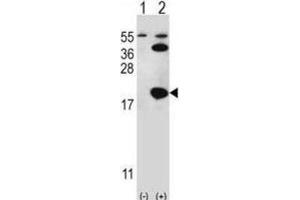 Western Blotting (WB) image for anti-Ubiquitin-Conjugating Enzyme E2I (UBE2I) antibody (ABIN2995752)