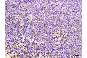 Formalin-fixed and paraffin embedded mouse lymphoma labeled with Anti-MuRF1/Trim63 Polyclonal Antibody, Unconjugated (ABIN687697) at 1:200 followed by conjugation to the secondary antibody and DAB staining. (CD7 抗体  (AA 181-240))