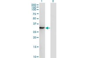 Western Blot analysis of SSX2 expression in transfected 293T cell line by SSX2 monoclonal antibody (M01), clone 1A4. (SSX2 抗体  (AA 1-223))