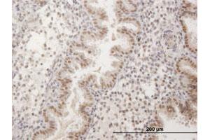 Immunohistochemistry (Formalin-fixed Paraffin-embedded Sections) (IHC (fp)) image for anti-FK506 Binding Protein 5 (FKBP5) (AA 1-457) antibody (ABIN515669)