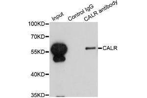Immunoprecipitation analysis of 200ug extracts of HepG2 cells using 1ug CALR antibody. (Calreticulin 抗体)