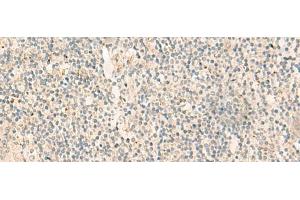 Immunohistochemistry of paraffin-embedded Human tonsil tissue using NGEF Polyclonal Antibody at dilution of 1:35(x200) (NGEF 抗体)