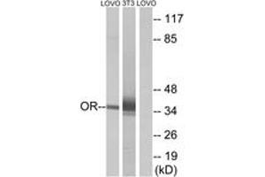 Western Blotting (WB) image for anti-Olfactory Receptor, Family 4, Subfamily D, Member 6 (OR4D6) (AA 260-309) antibody (ABIN2891007) (OR4D6 抗体  (AA 260-309))