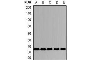 Western blot analysis of CD319 expression in A549 (A), SKOV3 (B), mouse spleen (C), mouse lung (D), rat testis (E) whole cell lysates. (SLAMF7 抗体)