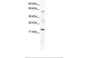 Image no. 1 for anti-Casein Kinase 1, gamma 1 (CSNK1G1) (AA 279-328) antibody (ABIN202567) (CSNK1G1 抗体  (AA 279-328))