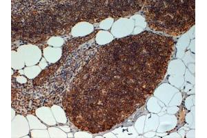 ABIN185069 (4µg/ml) staining of paraffin embedded Human Thymus. (FOXN1 抗体  (C-Term))