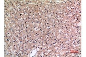 Immunohistochemical analysis of paraffin-embedded human-liver, antibody was diluted at 1:100.