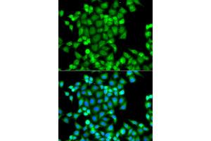 Immunofluorescence analysis of A549 cells using PAK2 antibody. (PAK2 抗体)