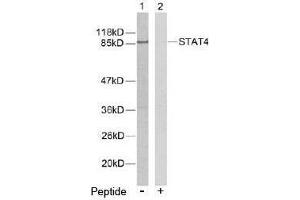 Image no. 2 for anti-Signal Transducer and Activator of Transcription 4 (STAT4) (Tyr693) antibody (ABIN197179) (STAT4 抗体  (Tyr693))