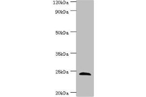 Western blot All lanes: SOST antibody at 4 μg/mL + Hela whole cell lysate Secondary Goat polyclonal to rabbit IgG at 1/10000 dilution Predicted band size: 24 kDa Observed band size: 24 kDa (Sclerostin 抗体  (AA 24-213))