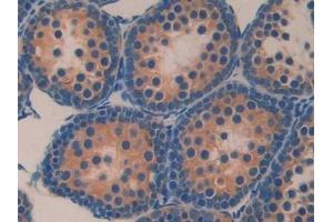 Immunohistochemistry (IHC) image for anti-Klotho beta (KLB) (AA 380-506) antibody (ABIN7438571)