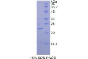 SDS-PAGE analysis of Horse Interleukin 1 alpha Protein.