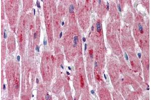 Human Heart: Formalin-Fixed, Paraffin-Embedded (FFPE) (DMPK 抗体  (AA 323-372))