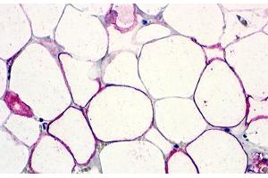 Image no. 1 for anti-G Protein-Coupled Receptor 77 (GPR77) (Extracellular Domain) antibody (ABIN1048365) (GPR77 抗体  (Extracellular Domain))