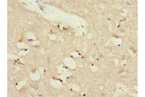 Immunohistochemistry of paraffin-embedded human brain tissue using ABIN7143394 at dilution of 1:100 (LPHN2 抗体  (AA 400-480))