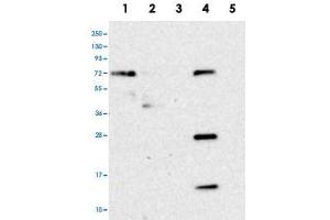 Western blot analysis of Lane 1: RT-4, Lane 2: U-251 MG, Lane 3: Human Plasma, Lane 4: Liver, Lane 5: Tonsil with HS2ST1 polyclonal antibody . (HS2ST1 抗体)