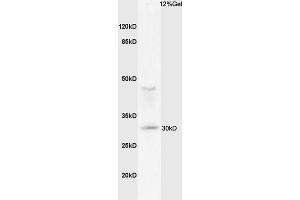 Mouse lung lysates probed with Anti MHC Class II Polyclonal Antibody, Unconjugated (ABIN1713842) at 1:200 overnight at 4 °C. (MHC Class II 抗体  (AA 111-200))