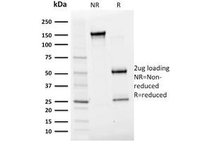 SDS-PAGE (SDS) image for anti-Albumin (ALB) antibody (ABIN6939359)