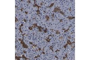 Immunohistochemical staining of human pancreas with DSCR4 polyclonal antibody  shows strong cytoplasmic positivity in pancreatic duct cells.