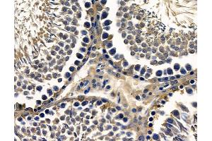 ABIN7096802 and ABIN7100868 at 1/100 staining rat testis tissue by IHC-P.