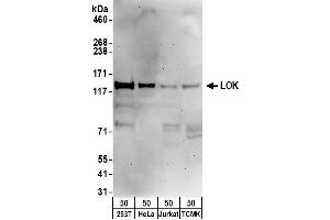 anti-Serine/threonine Kinase 10 (STK10-A) (C-Term) antibody