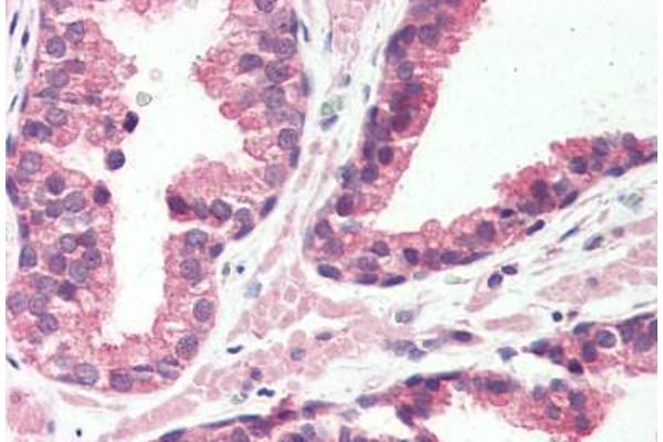 G Protein-Coupled Receptor 126 抗体  (N-Term)