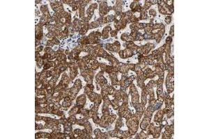 Immunohistochemical staining (Formalin-fixed paraffin-embedded sections) of human liver with ACAT1 polyclonal antibody  shows strong cytoplasmic positivity in hepatocytes. (ACAT1 抗体)