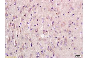 Formalin-fixed and paraffin embedded rat brain labeled with Rabbit Anti KRIT1 Polyclonal Antibody, Unconjugated (ABIN1387606) at 1:200 followed by conjugation to the secondary antibody and DAB staining (KRIT1 抗体  (AA 631-736))