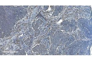 IHC analysis of TIMM8A/DDP using anti-TIMM8A/DDP antibody (ABIN7600039). (TIMM8A/DDP 抗体  (AA 14-97))