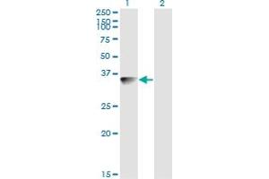 Western Blot analysis of BLVRA expression in transfected 293T cell line by BLVRA monoclonal antibody (M03), clone S2. (Biliverdin Reductase 抗体  (AA 1-296))