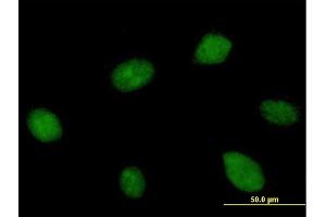 Immunofluorescence of purified MaxPab antibody to KIAA1604 on HeLa cell. (CWC22 抗体  (AA 1-908))
